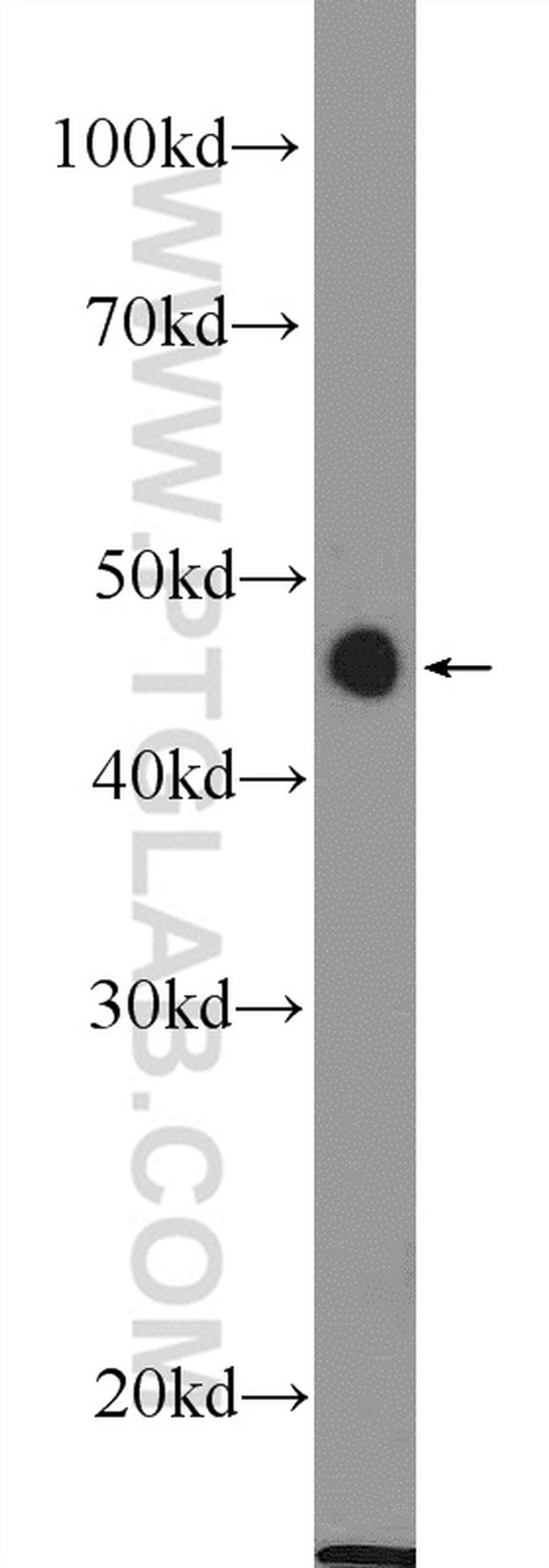 MTERFD1 Antibody in Western Blot (WB)