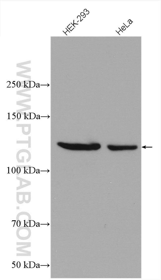 Eg5 Antibody in Western Blot (WB)