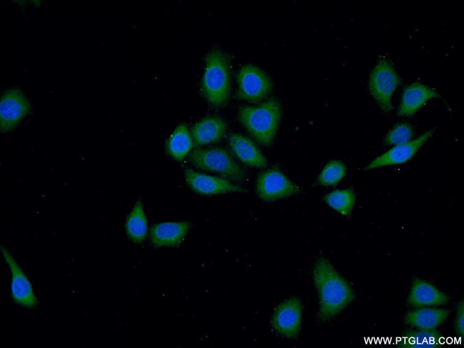 DOCK180 Antibody in Immunocytochemistry (ICC/IF)