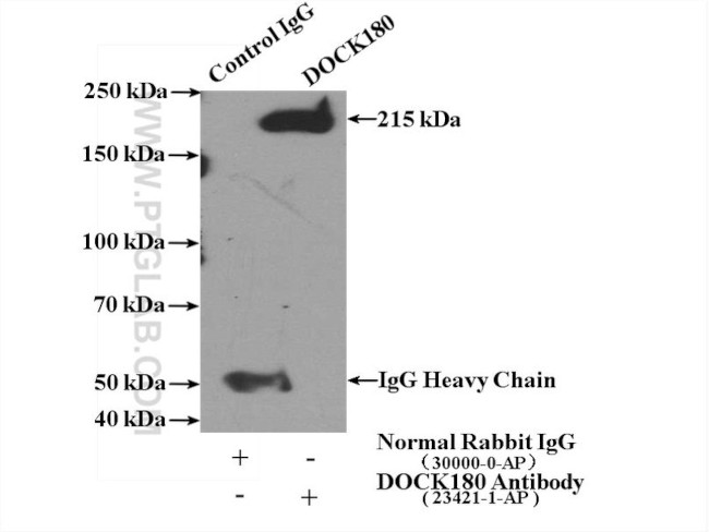 DOCK180 Antibody in Immunoprecipitation (IP)