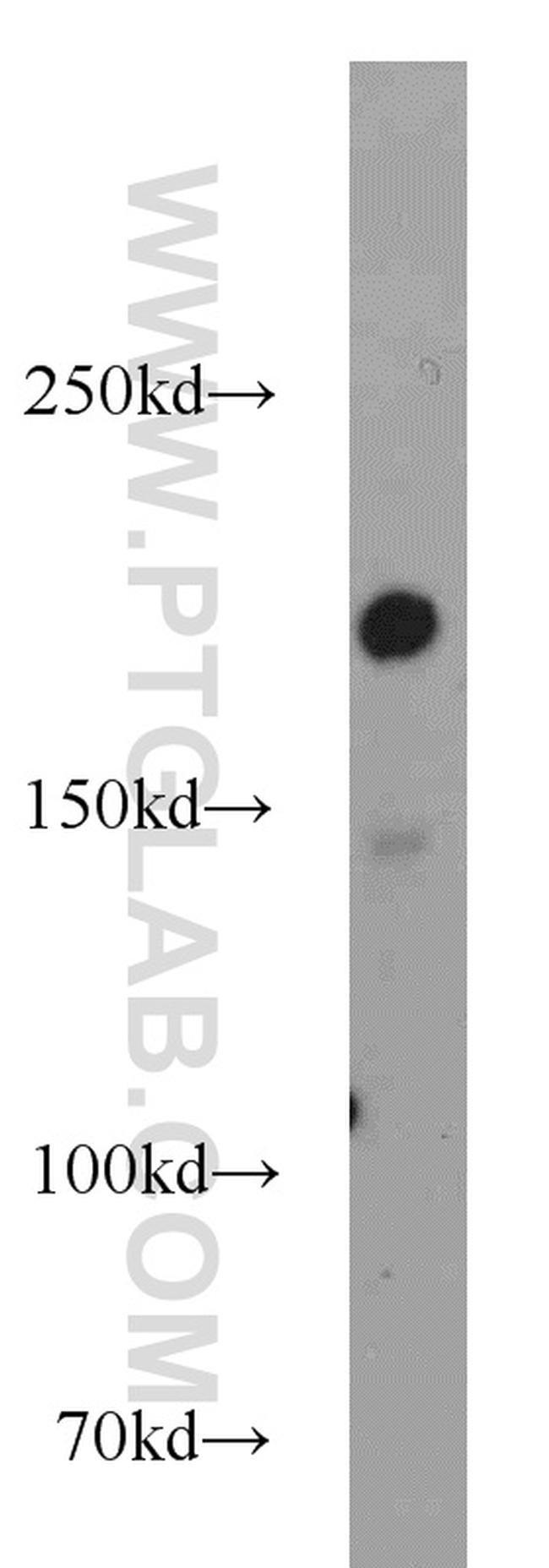 DOCK180 Antibody in Western Blot (WB)