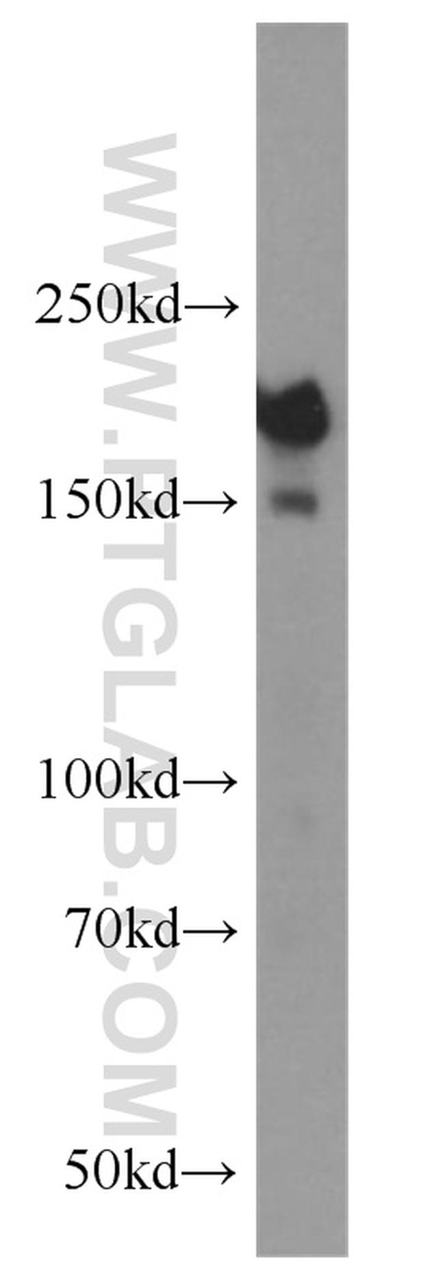 DOCK180 Antibody in Western Blot (WB)