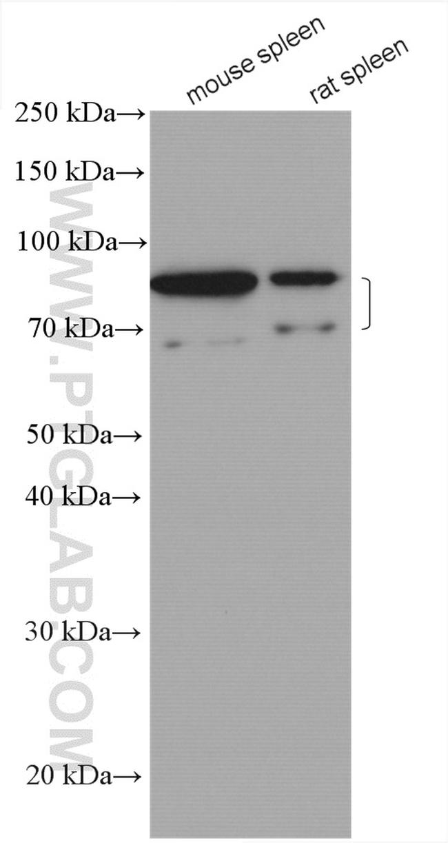 IL-6R Antibody in Western Blot (WB)