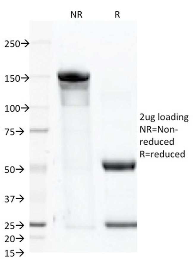 FOLH1/PSMA Antibody in SDS-PAGE (SDS-PAGE)