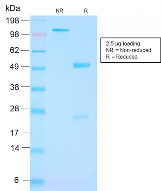 FOLH1/PSMA Antibody in SDS-PAGE (SDS-PAGE)