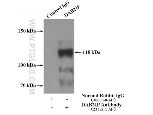 DAB2IP Antibody in Immunoprecipitation (IP)