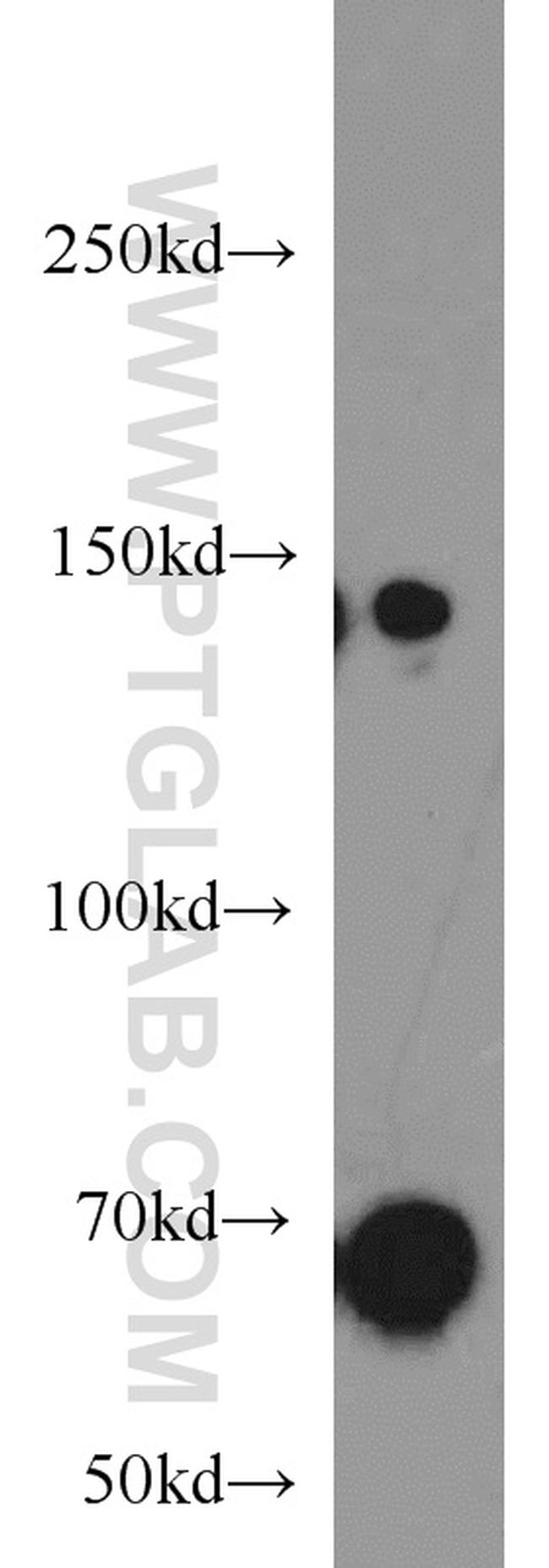 PRDM10 Antibody in Western Blot (WB)