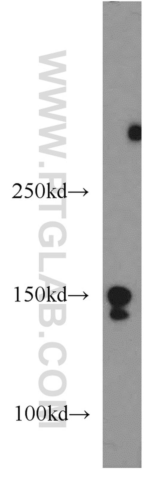 PRDM10 Antibody in Western Blot (WB)