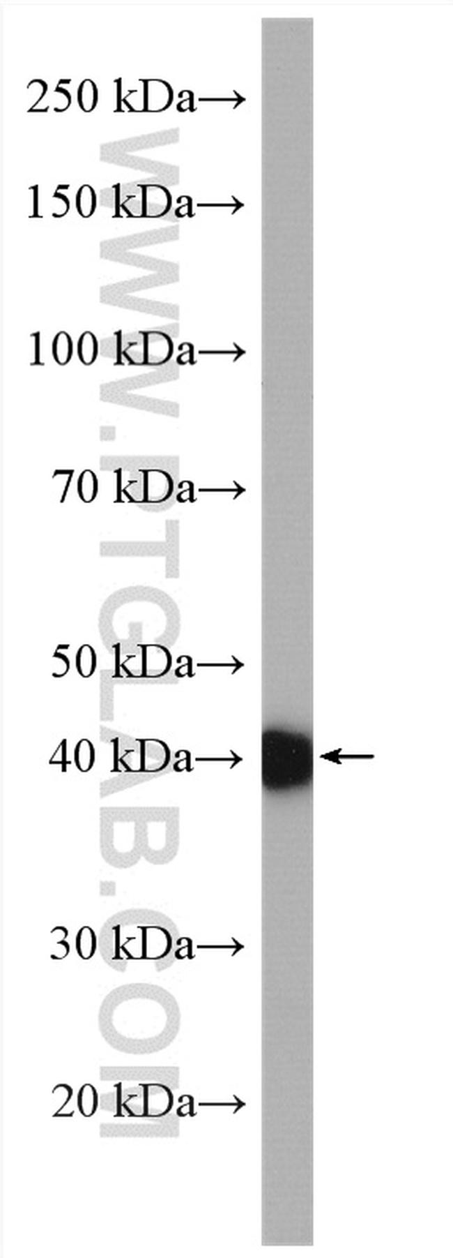 CEP89 Antibody in Western Blot (WB)