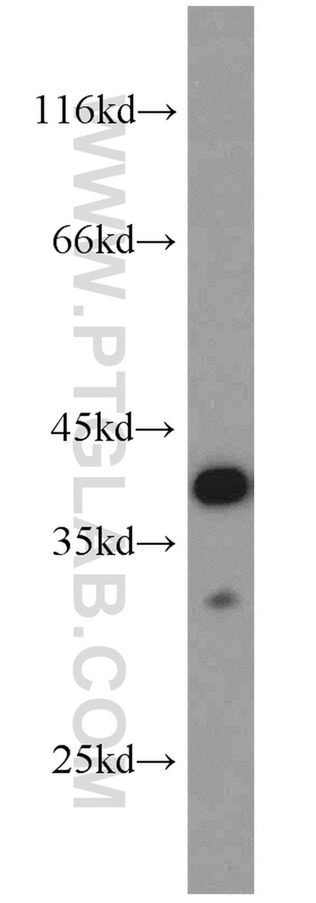 PCNA Antibody in Western Blot (WB)