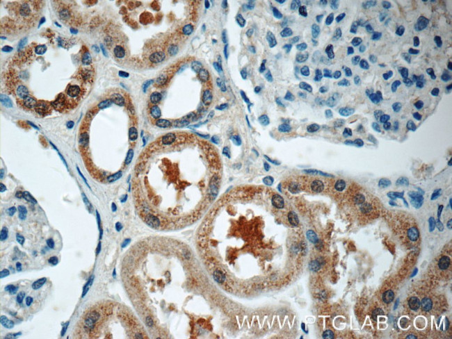 HSN2 Antibody in Immunohistochemistry (Paraffin) (IHC (P))