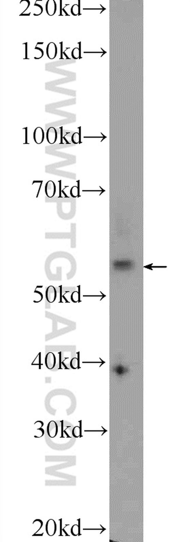 NHEDC2 Antibody in Western Blot (WB)