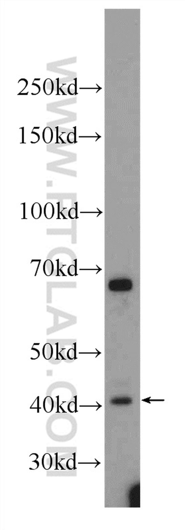 TMEM59 Antibody in Western Blot (WB)