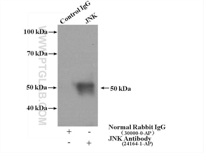 JNK Antibody in Immunoprecipitation (IP)