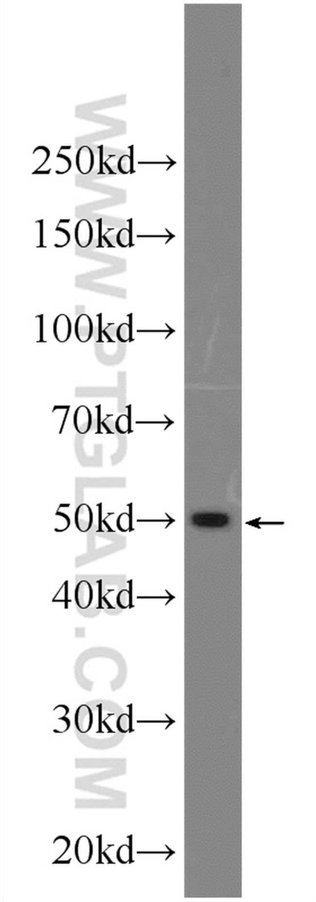 Sodium Iodide Symporter Antibody in Western Blot (WB)