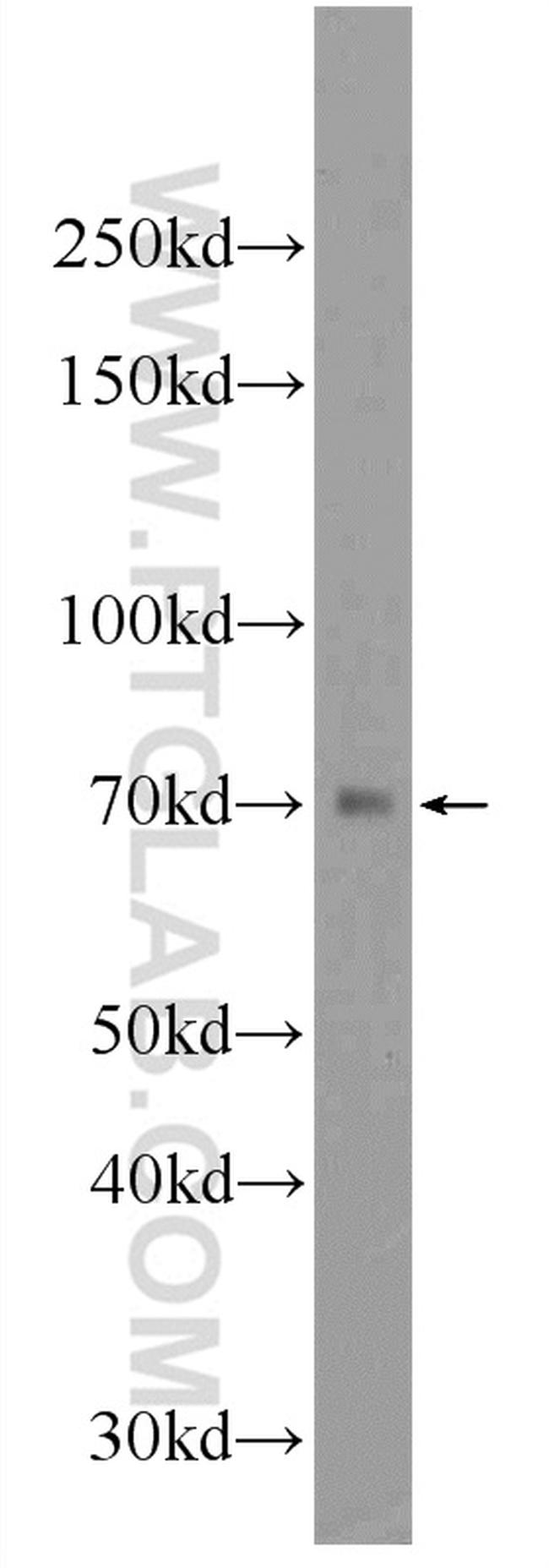 SGLT3/SLC5A4 Antibody in Western Blot (WB)