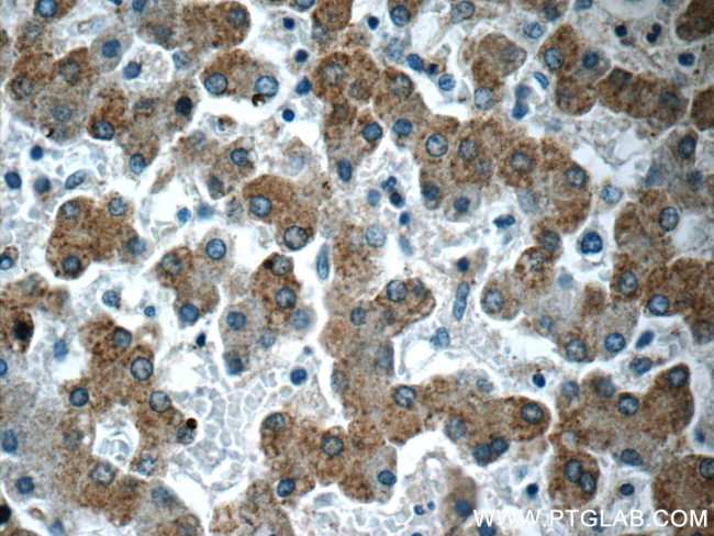 CCDC53 Antibody in Immunohistochemistry (Paraffin) (IHC (P))