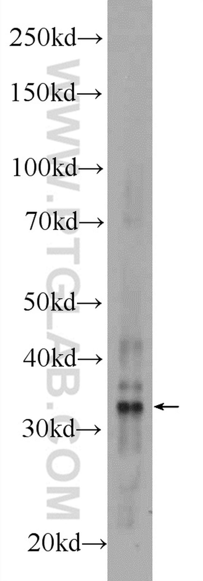 AMZ1 Antibody in Western Blot (WB)