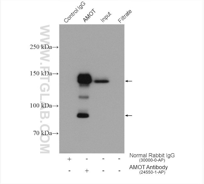 AMOT Antibody in Immunoprecipitation (IP)