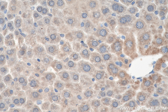 SLC22A1 Antibody in Immunohistochemistry (Paraffin) (IHC (P))