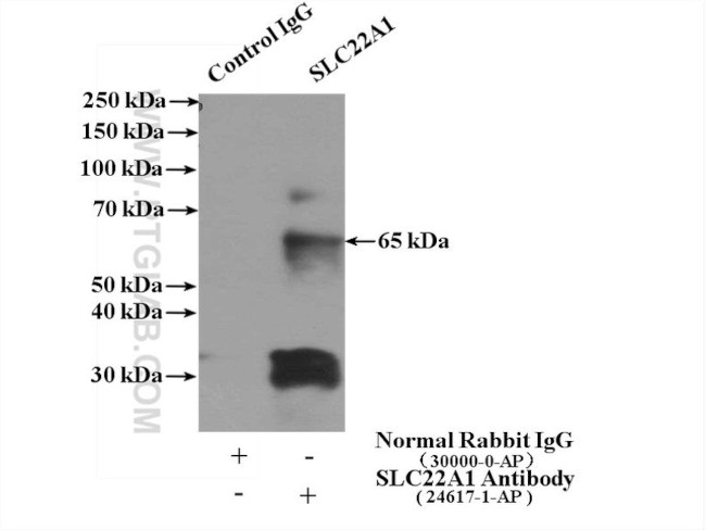 SLC22A1 Antibody in Immunoprecipitation (IP)