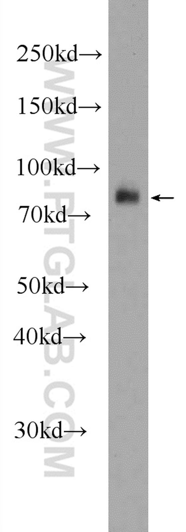 MEP1A Antibody in Western Blot (WB)