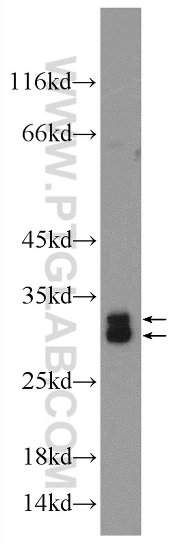 SRA1 Antibody in Western Blot (WB)