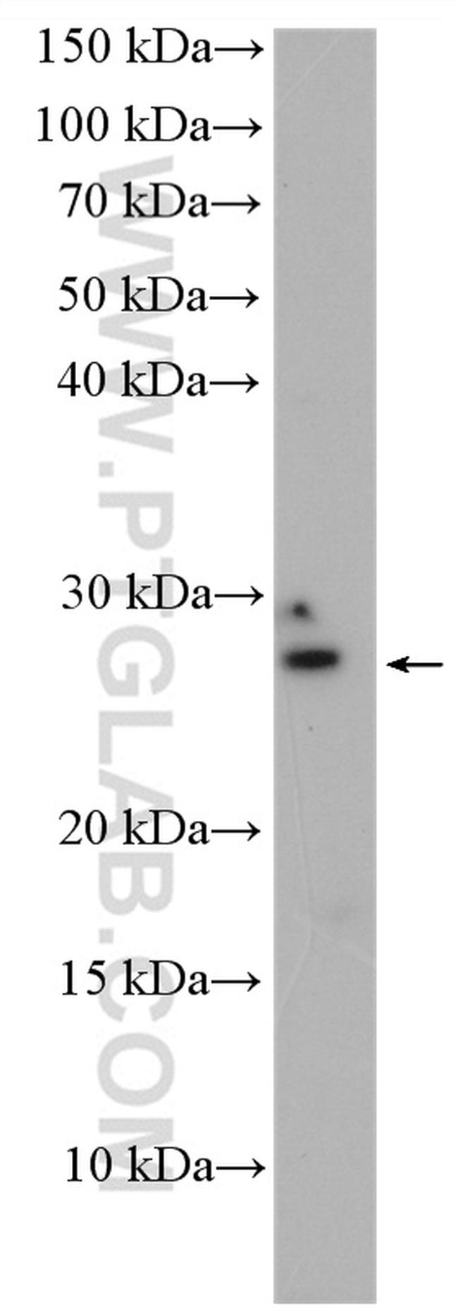 INSIG2 Antibody in Western Blot (WB)