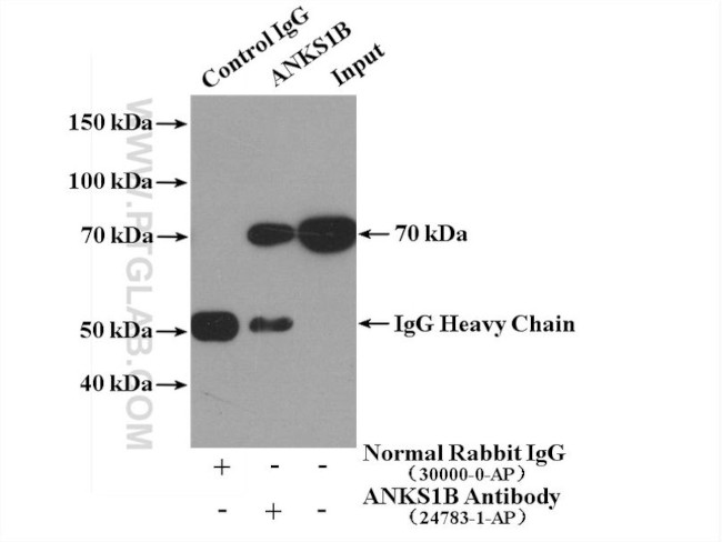ANKS1B Antibody in Immunoprecipitation (IP)