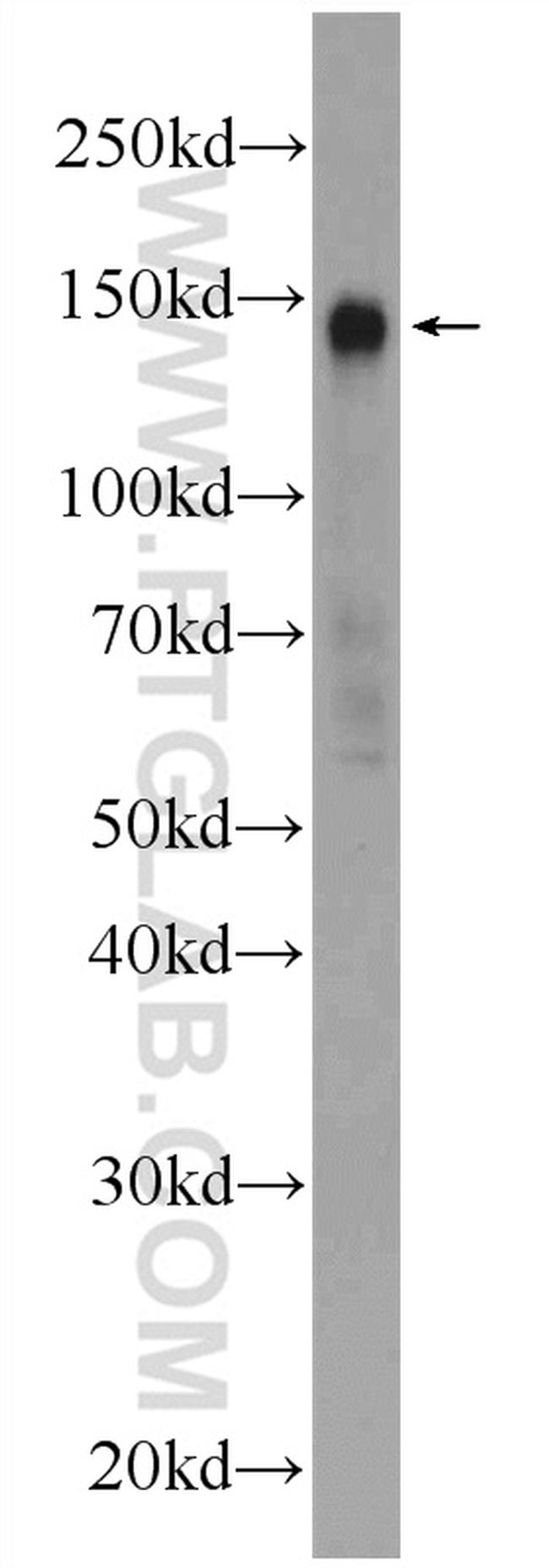PHF14 Antibody in Western Blot (WB)