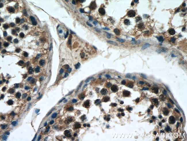 ZNF658 Antibody in Immunohistochemistry (Paraffin) (IHC (P))