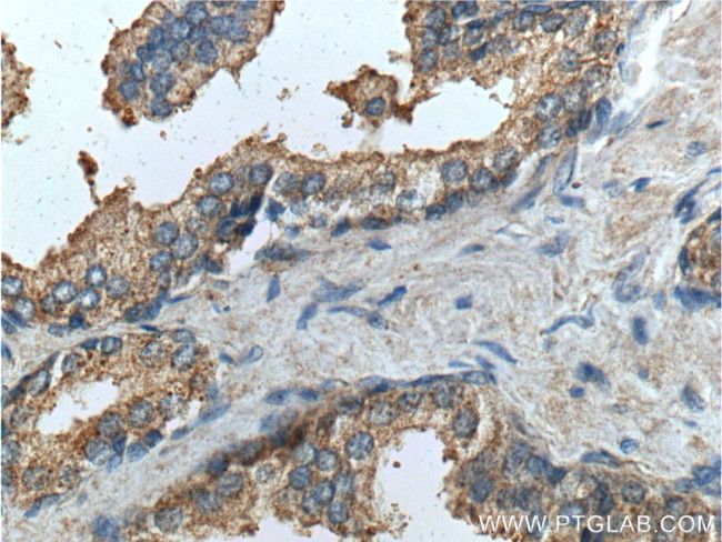 PTGER4 Antibody in Immunohistochemistry (Paraffin) (IHC (P))