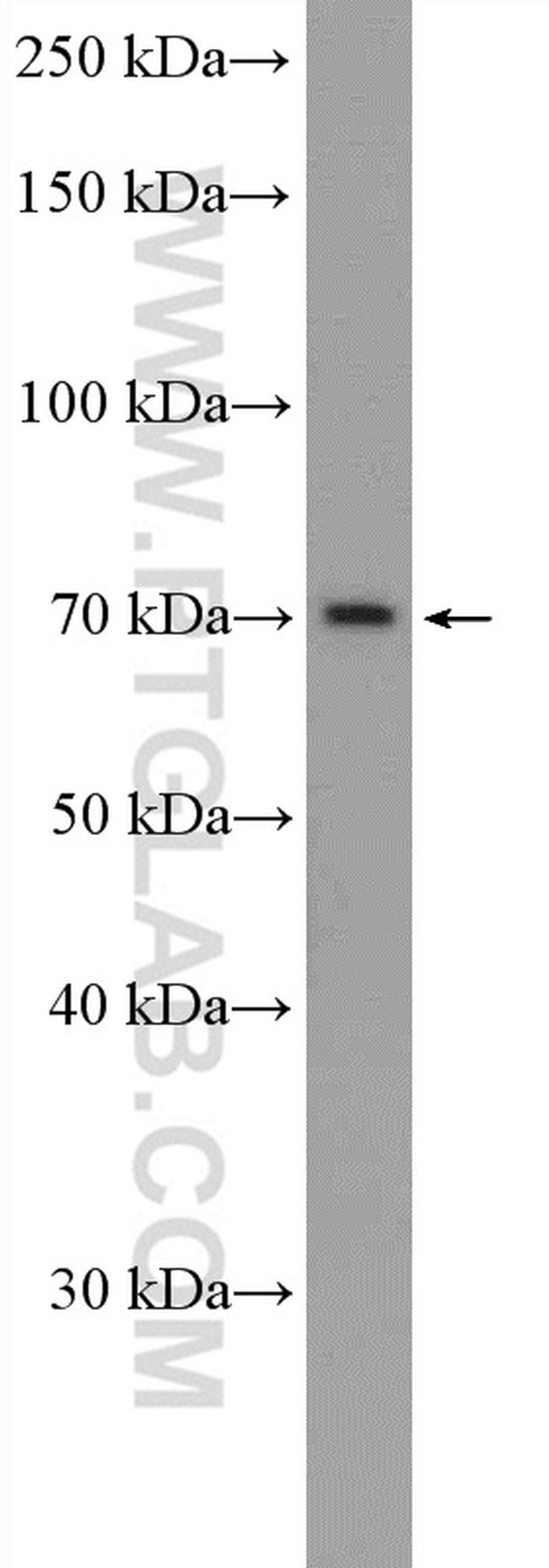 ZNF30 Antibody in Western Blot (WB)