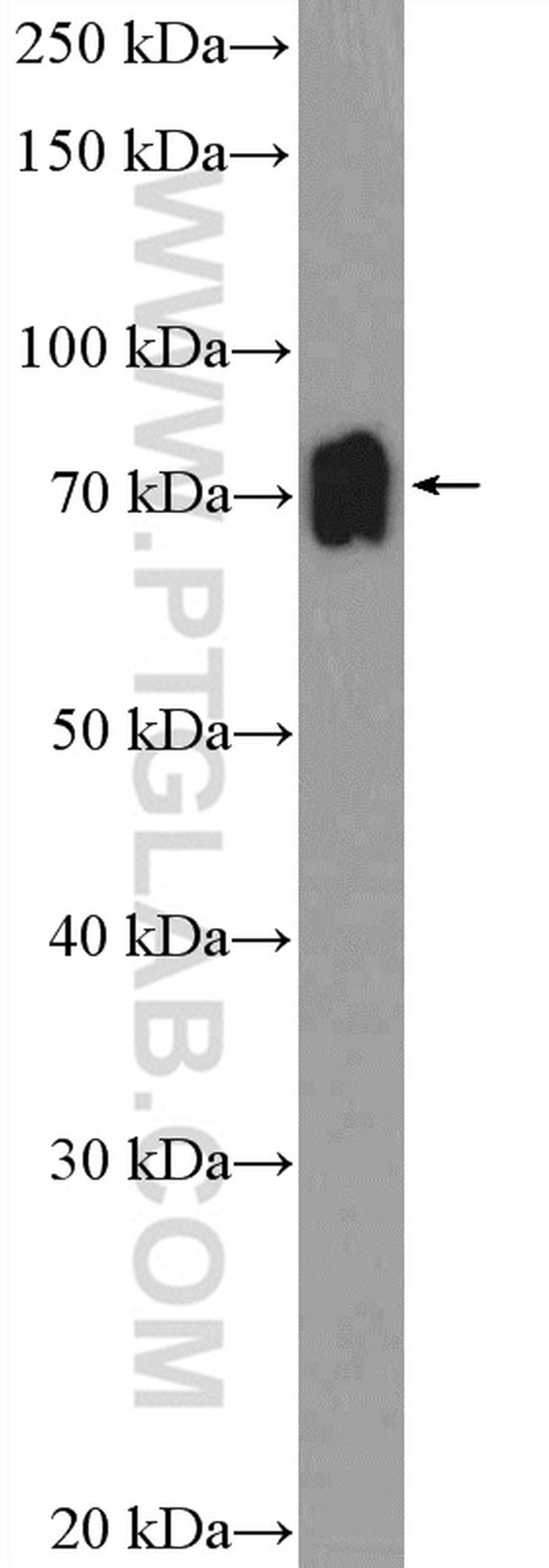 ZNF30 Antibody in Western Blot (WB)