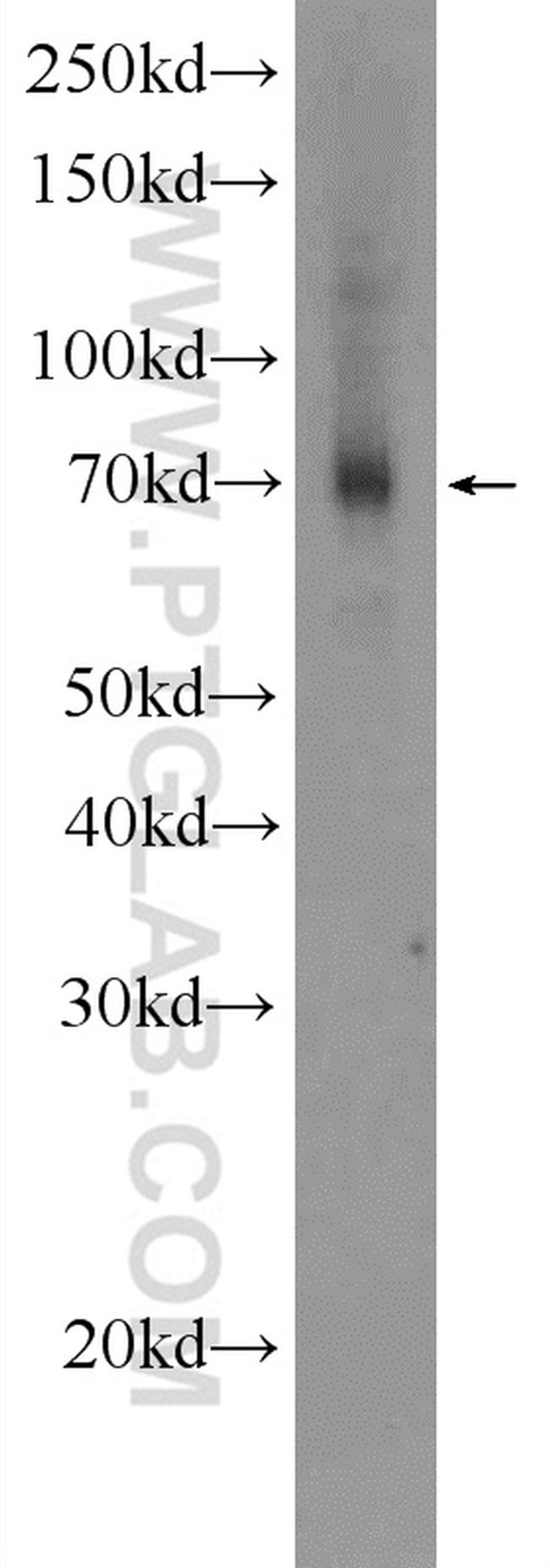 FDXACB1 Antibody in Western Blot (WB)