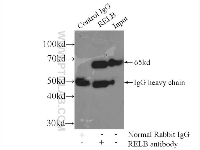 RelB Antibody in Immunoprecipitation (IP)