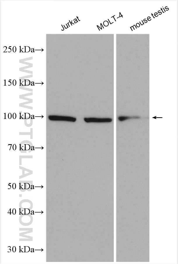 C19orf57 Antibody in Western Blot (WB)