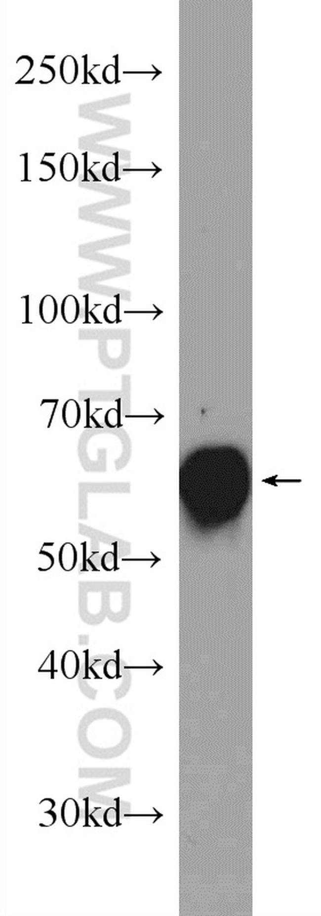 GDPD2 Antibody in Western Blot (WB)