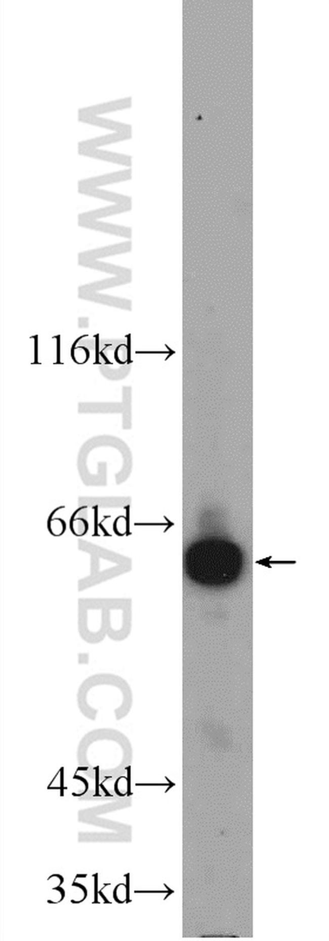 GPR107 Antibody in Western Blot (WB)