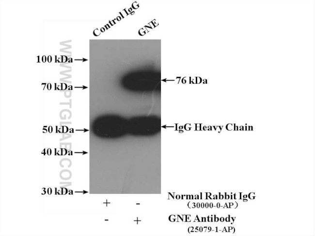 GNE Antibody in Immunoprecipitation (IP)