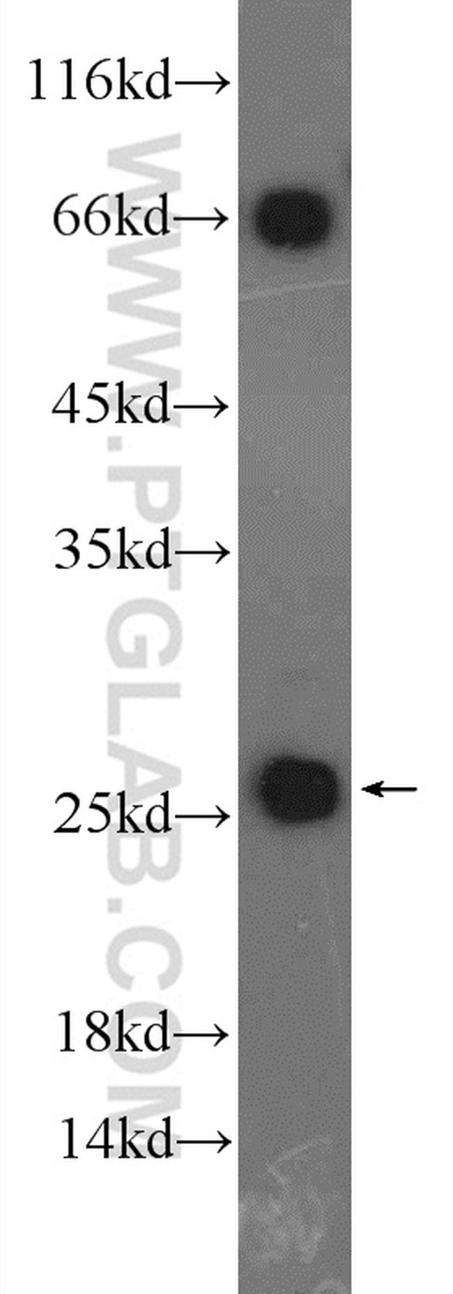 NDUFS8 Antibody in Western Blot (WB)