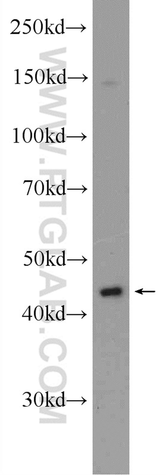 TACR2 Antibody in Western Blot (WB)