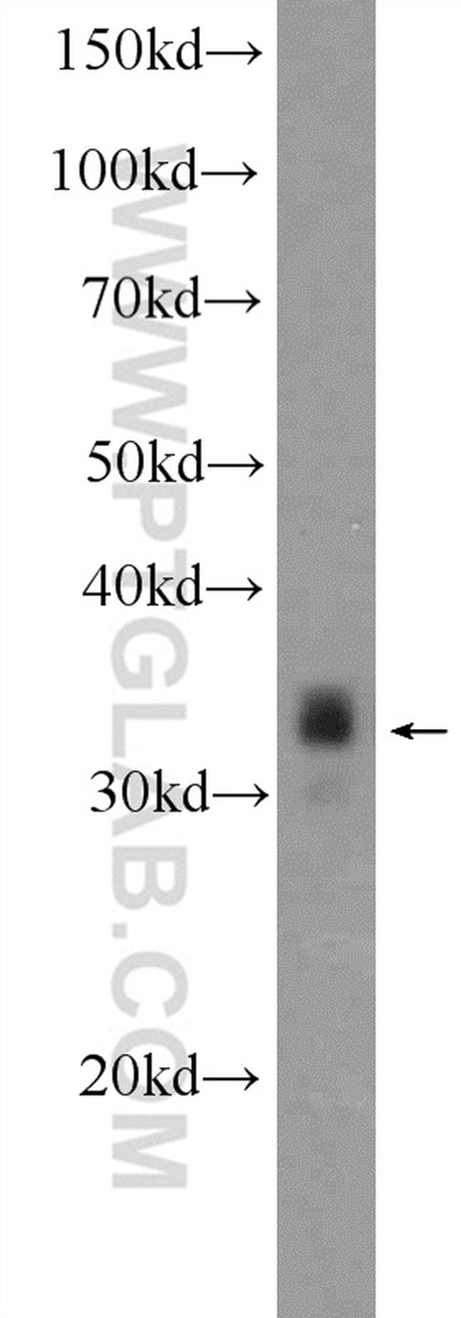PHOX2B Antibody in Western Blot (WB)