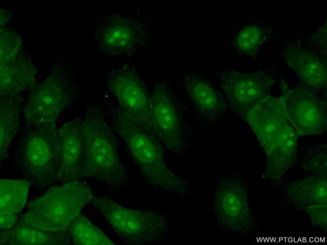 EXOSC7 Antibody in Immunocytochemistry (ICC/IF)