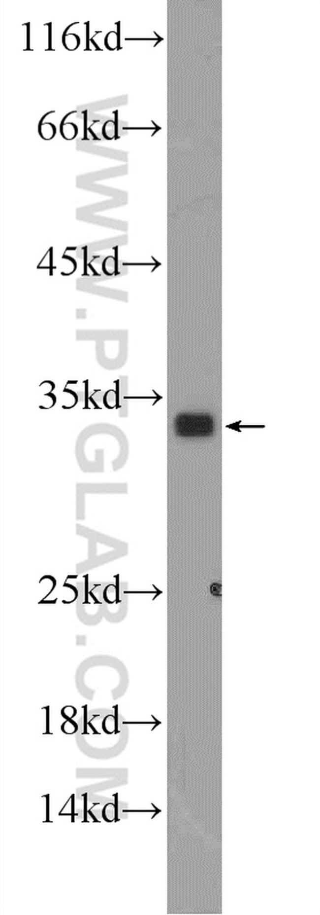 FGF17 Antibody in Western Blot (WB)