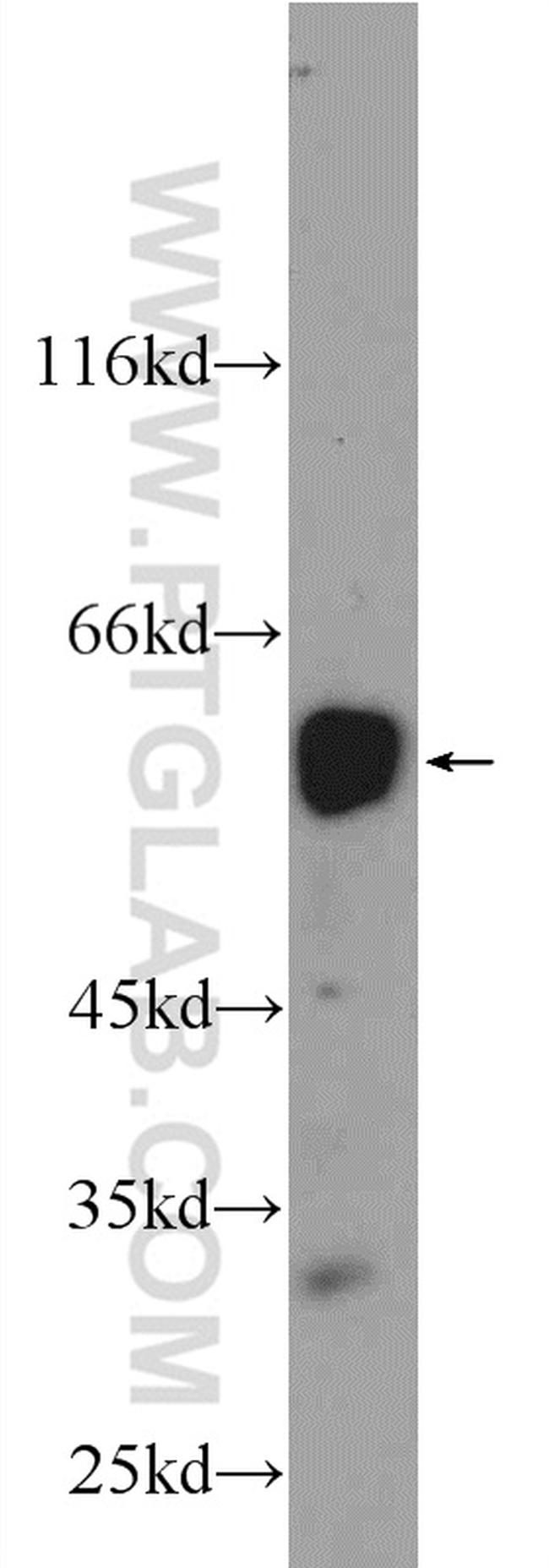 RUNX1 (middle) Antibody in Western Blot (WB)
