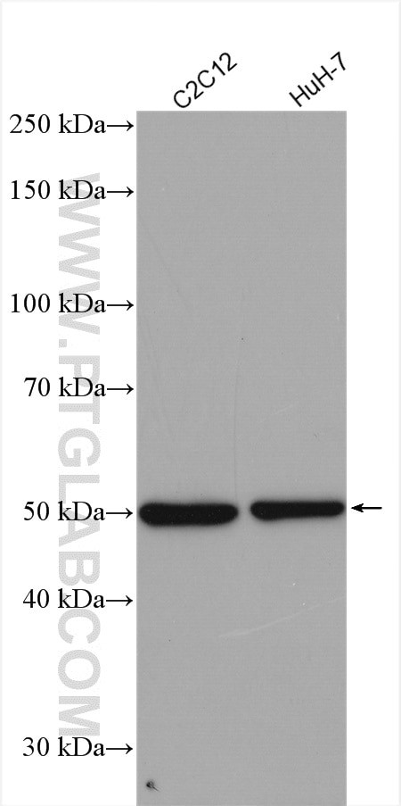 AGTR1 Antibody in Western Blot (WB)