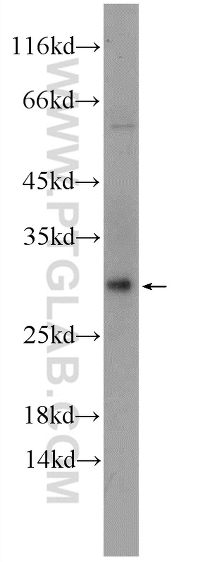 C3orf43 Antibody in Western Blot (WB)