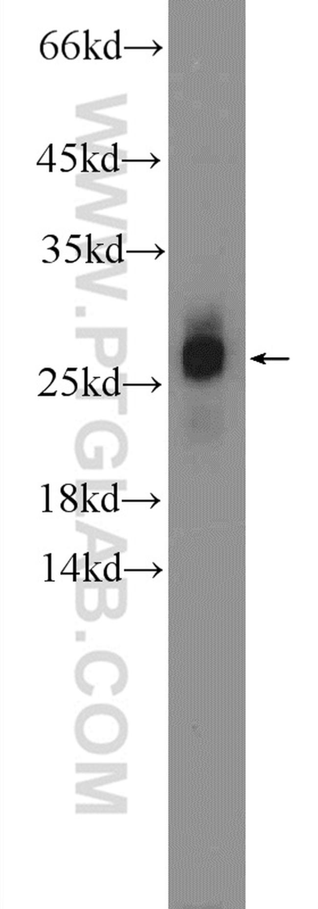 ZNF740 Antibody in Western Blot (WB)