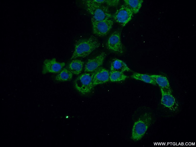 C1orf156 Antibody in Immunocytochemistry (ICC/IF)